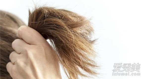 为什么夏天掉头发多 夏天掉头发多怎么办