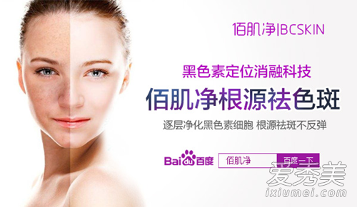 脸上的雀斑怎么去掉 遗传的雀斑能去掉吗