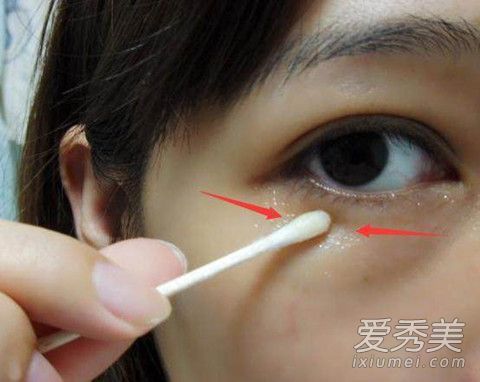 阿司匹林去眼袋吗 阿司匹林去眼袋的方法