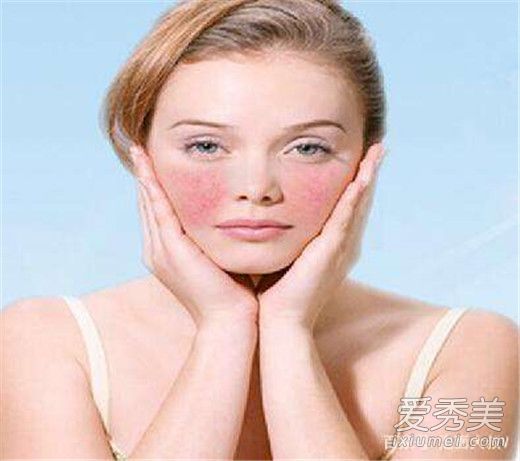 肌肤过敏怎么办 肌肤过敏的原因